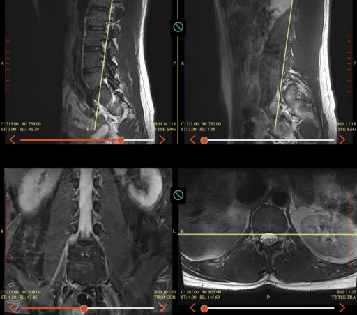 MRI scan that inspired the developer to build a more efficient workout tool